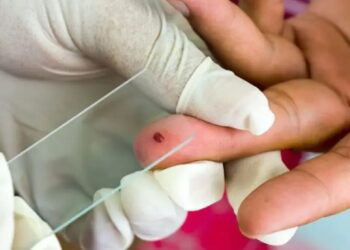 நைஜீரியாவில் இருந்து வந்த யாழ் இளைஞனுக்கு மலேரியா தொற்று!