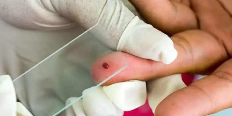 நைஜீரியாவில் இருந்து வந்த யாழ் இளைஞனுக்கு மலேரியா தொற்று!