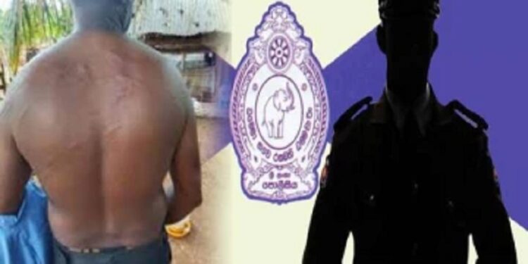 காவல்துறையின் அடாவடி படுகாயங்களுடன் குடும்பஸ்தர்!