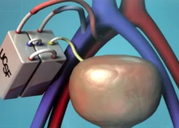 மருத்துவ உலகில் செயற்கை சிறுநீரகத்தை உருவாக்கிய விஞ்ஞானிகள்