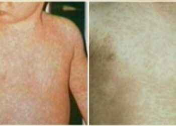 அந்தஸ்தை இழக்க கூடிய நிலையில் கனடா!