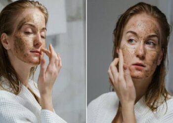 . முகப்பரு, கரும்புள்ளியை போக்கும்  சீரகம்