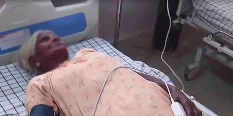 குளவிக் கொட்டுக்கு இலககான 13 பேர் வைத்தியசாலையில்