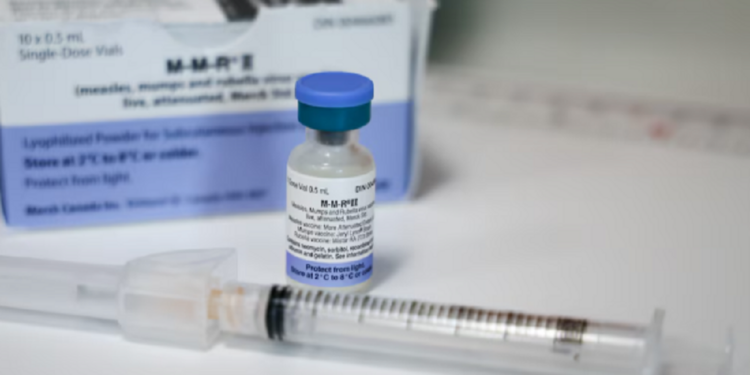 கனடாவில் தட்டம்மை நோயால் பதிவான மரணம்!